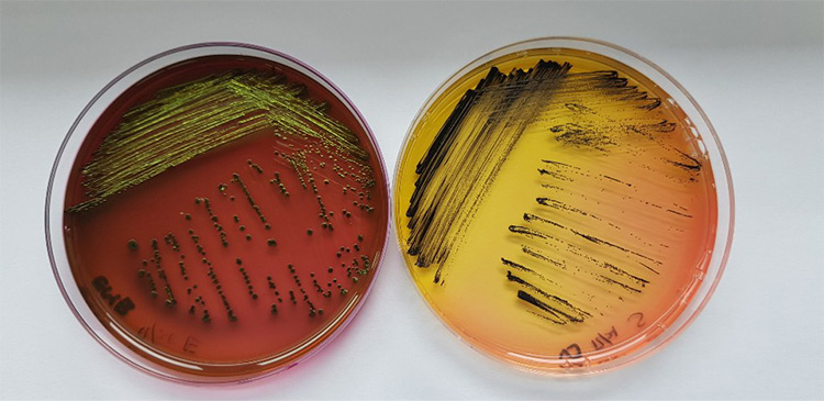 화장품 미생물 한도 시험